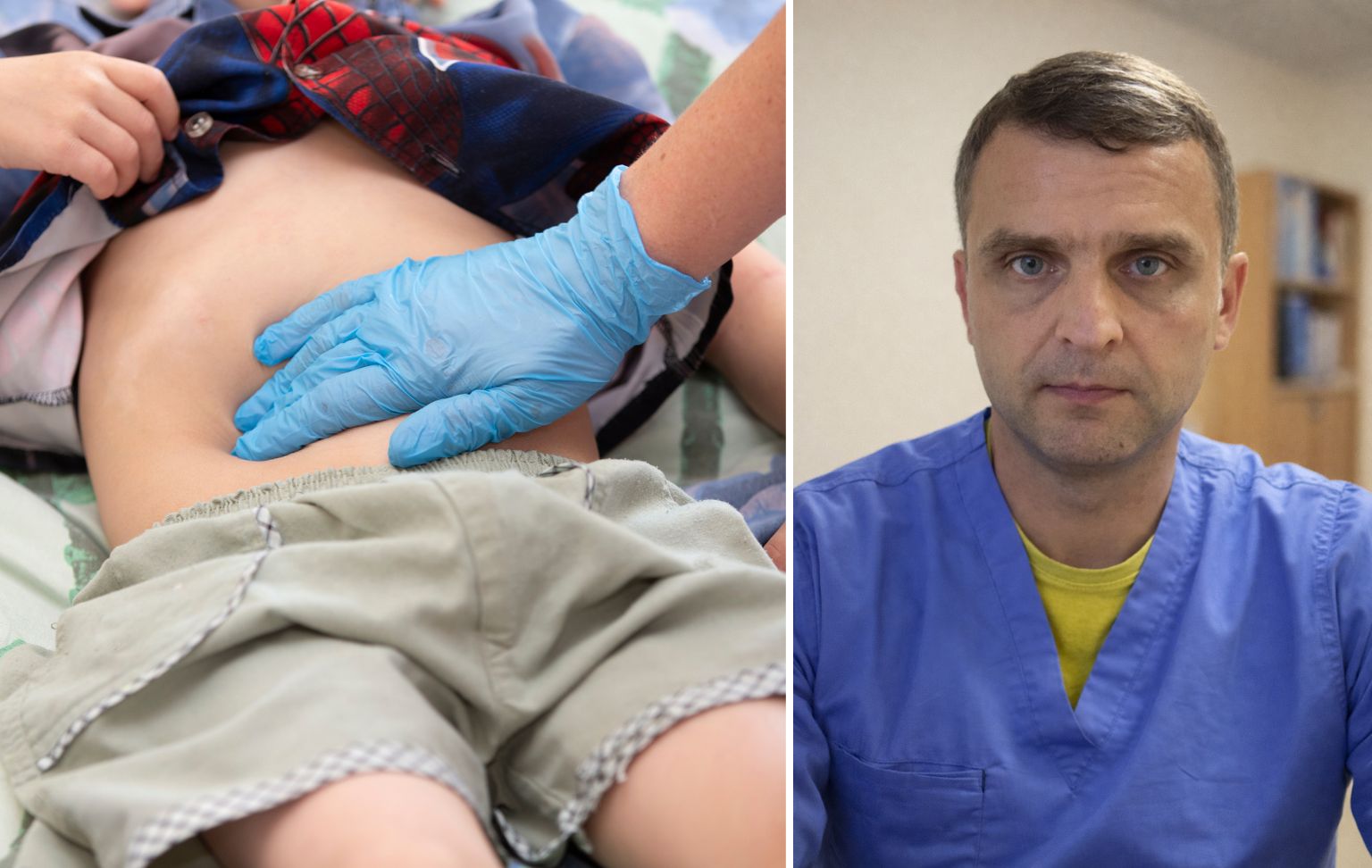 Nematomas pavojus po smūgio: vaikų pilvo traumos, kurių nereikėtų nuvertinti